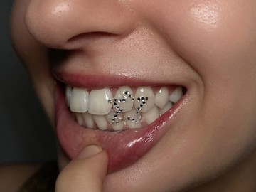 Tooth Gem Foto: dok. Instagram @smileandwink.co
