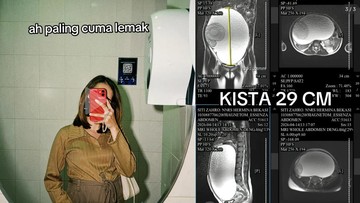 Foto: tangkapan layar viral